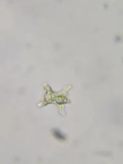 Staurastrum inconspicuum thumbnail 2