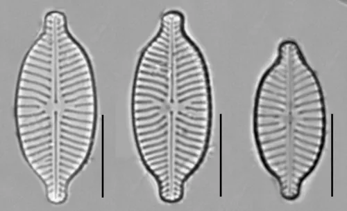 Placoneis anglophila