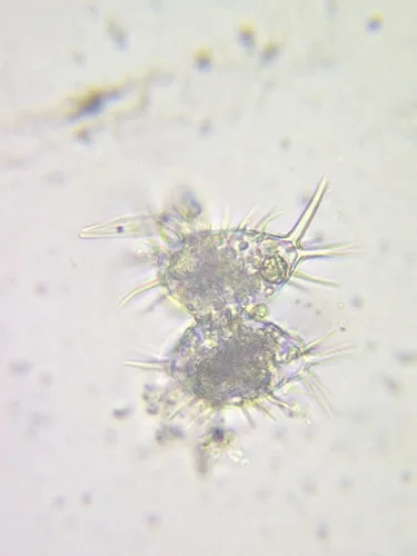Staurastrum setigerum