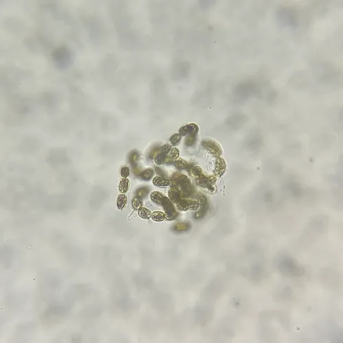 Dolichospermum lemmermannii