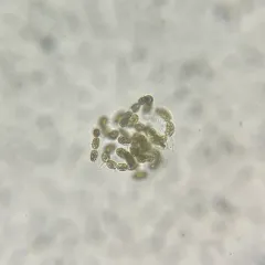 Dolichospermum lemmermannii thumbnail 1