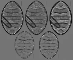 Surirella undulata thumbnail 2
