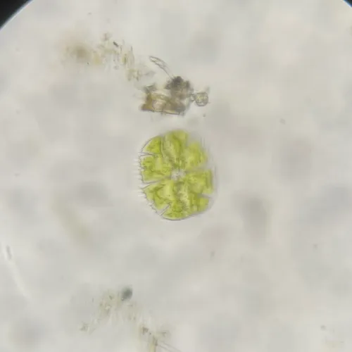 Micrasterias truncata