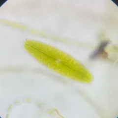 Netrium digitus thumbnail 1
