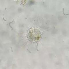 Actinophrys sol thumbnail 2