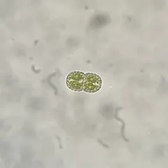Cosmarium amoenum thumbnail 1