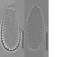 Surirella brebissonii thumbnail 2