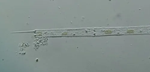 Aulacoseira granulata