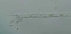 Aulacoseira granulata thumbnail 1