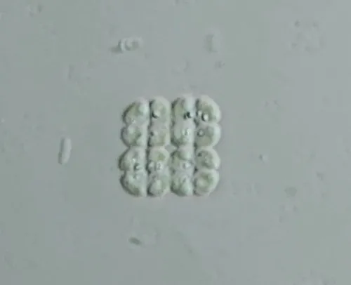 Crucigenia quadrata
