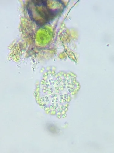 Coelosphaerium aerugineum