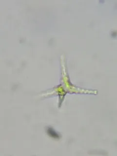Staurastrum tetracerum thumbnail 2
