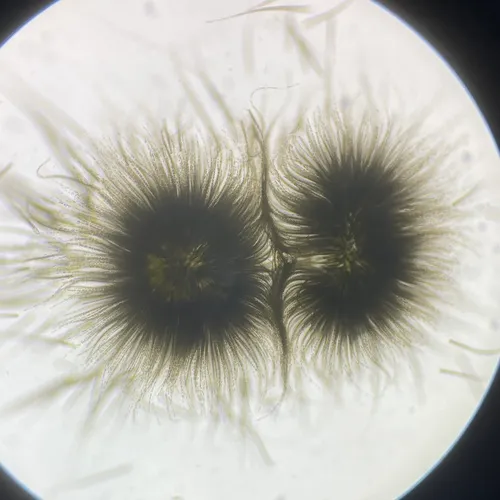 Gloeotrichia echinulata