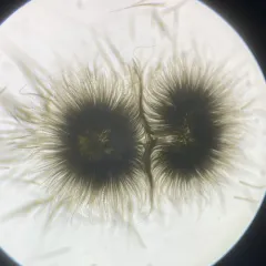 Gloeotrichia echinulata thumbnail 1