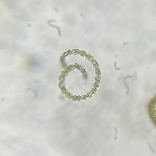 Dolichospermum circinale