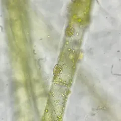 Cocconeis pediculus thumbnail 1