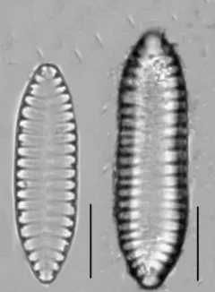 Surirella angusta thumbnail 3