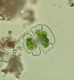 Micrasterias truncata thumbnail 3