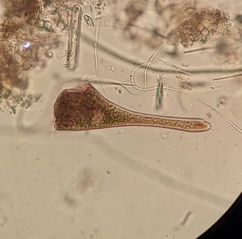Stentor amethystinus