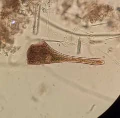 Stentor amethystinus thumbnail 1