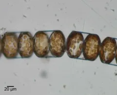Melosira inflexa thumbnail 4