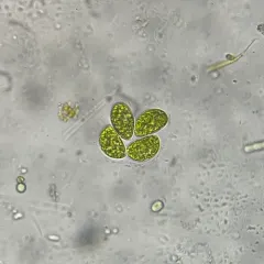 Nephrocytium limneticum thumbnail 2
