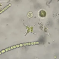 Staurastrum tetracerum thumbnail 1