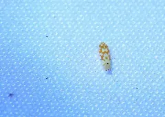 Erythroneura rubrella thumbnail 2