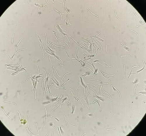 Mulberry Leaf Spot