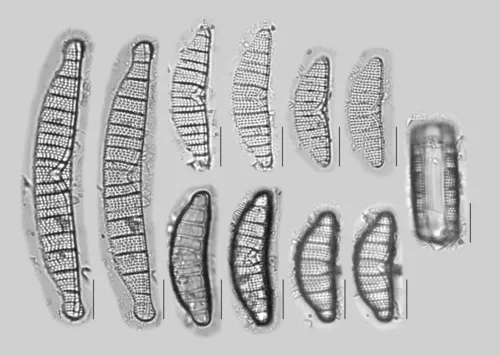 Epithemia adnata