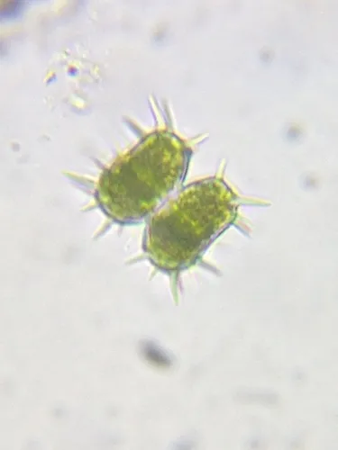 Staurastrum quadrispinatum