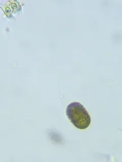 Trachelomonas hispida thumbnail 1