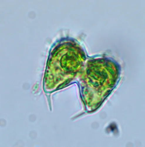 Staurodesmus glaber