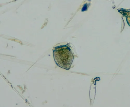 Dinophysis norvegica
