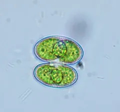 Cosmarium phaseolus thumbnail 2