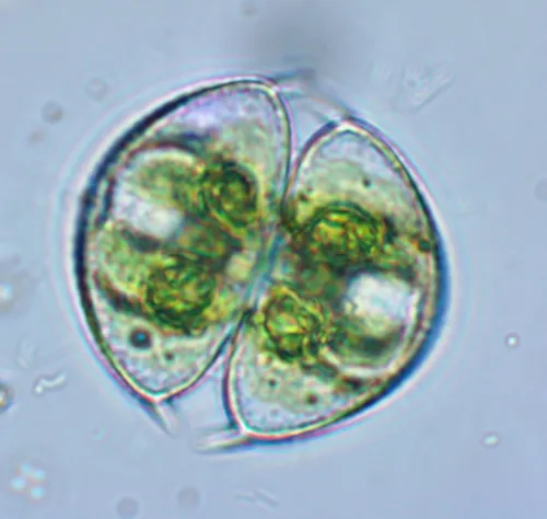 Staurodesmus dickiei
