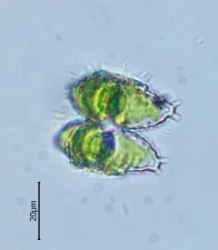 Staurastrum avicula thumbnail 2
