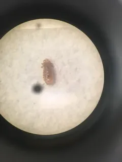 House Rat Louse thumbnail 4