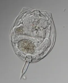 Lecane closterocerca thumbnail 1