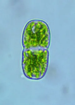 Actinotaenium cucurbita thumbnail 2