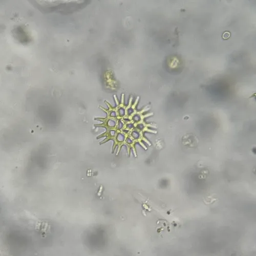 Lacunastrum gracillimum