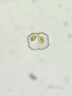 Cosmarium punctulatum thumbnail 3