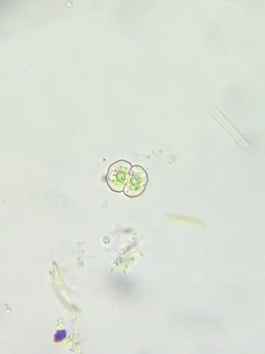 Cosmarium angulosum