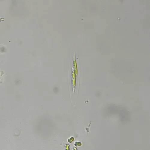 Elakatothrix genevensis