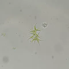 Ankistrodesmus densus thumbnail 1