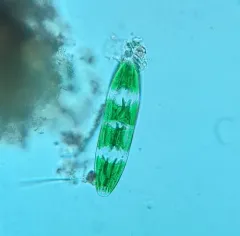 Planotaenium interruptum thumbnail 4
