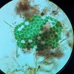 Pediastrum angulosum thumbnail 3