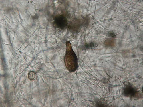Habrotrocha angusticollis