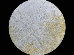 Miladina lecithina thumbnail 2