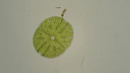 Micrasterias thomasiana